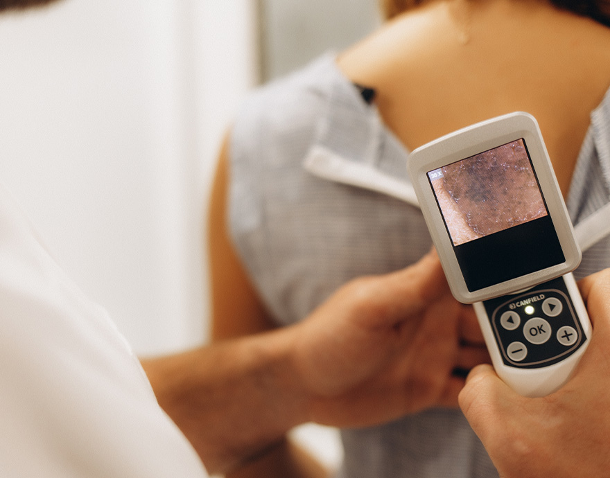 Skin Cancer Checks